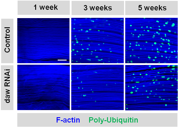 muscle protein